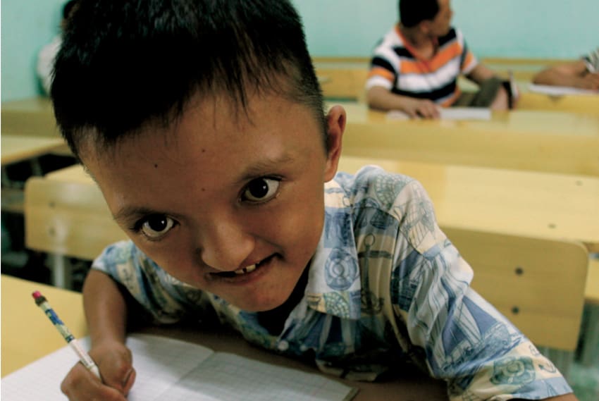 L&rsquo;agent orange continue de contaminer des milliers d&rsquo;enfants au Vietnam